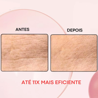 Creamy&#x20;S&#x00E9;rum&#x20;Facial&#x20;Retinal&#x20;&#x20;Noturno&#x20;Anti&#x20;Aging&#x20;30g&#x2705;PRONTA&#x20;ENTREGA