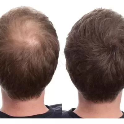 T&#x00F4;nico&#x20;Poderoso&#x20;&#x7C;&#x20;60&#x20;C&#x00E1;psulas&#x20;-&#x20;Cresc&#x20;Acelerado&#x20;&#x7C;&#x20;Anti-queda&#x20;Gold&#x20;Spell