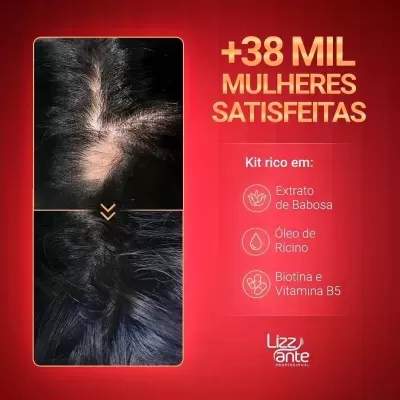 Kit&#x20;Lizz&#x20;ante&#x20;Professional&#x20;S.O.S