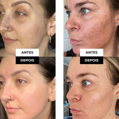 Kit&#x20;Dia&#x20;Noite&#x20;Serum&#x20;Visage&#x20;E&#x20;Unique&#x20;Saviora&#x20;Skincare&#x20;Rugas