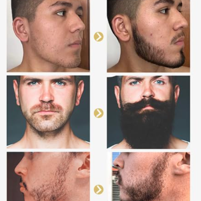 Kit&#x20;de&#x20;Crescimento&#x20;de&#x20;Barba