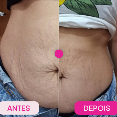 Creme&#x20;Adeus&#x20;Multifuncional&#x20;300g&#x2705;PRONTA&#x20;ENTREGA