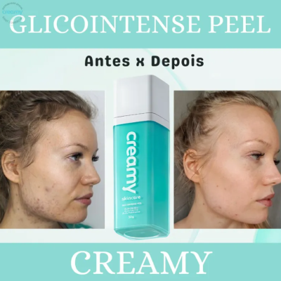Creamy&#x20;Glicointense&#x20;Peel&#x20;-&#x20;Antiacne&#x20;E&#x20;Manchas&#x20;30g&#x20;&#x2705;PRONTA&#x20;ENTREGA