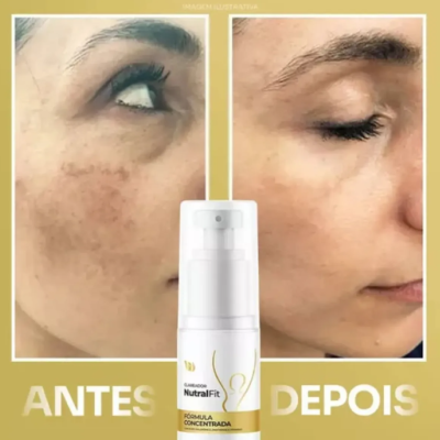 Clareador&#x20;Nutral&#x20;Fit&#x20;Corpo&#x20;E&#x20;Rosto&#x20;Concentrado&#x20;50ml