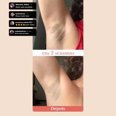 Clareador&#x20;De&#x20;Coxas&#x20;Cotovelos&#x20;Virilha&#x20;E&#x20;Axilas&#x20;Rosa&#x20;Mosqueta