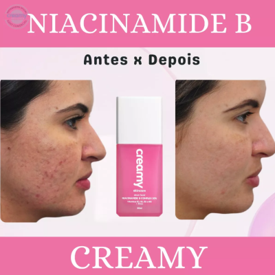 Creamy&#x20;Niacinamide&#x20;B&#x20;Complex&#x20;20&#x25;&#x20;&#x2705;PRONTA&#x20;ENTREGA