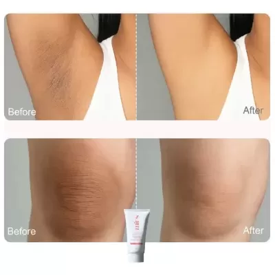 Clareador&#x20;De&#x20;Coxas&#x20;Cotovelos&#x20;Virilha&#x20;E&#x20;Axilas&#x20;Rosa&#x20;Mosqueta