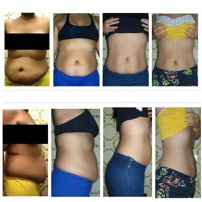 Mundial&#x20;Caps&#x20;Lipo&#x20;Bari&#x20;30&#x20;C&#x00E1;psulas&#x20;Inibidor&#x20;De&#x20;Apetite