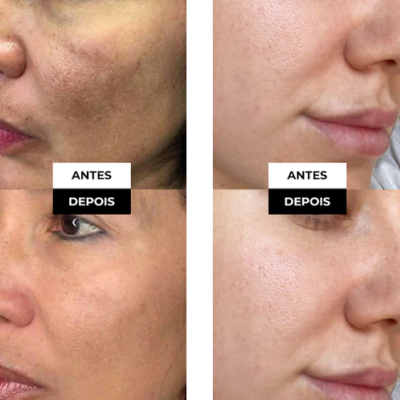 Kit&#x20;Dia&#x20;Noite&#x20;Serum&#x20;Visage&#x20;E&#x20;Unique&#x20;Saviora&#x20;Skincare&#x20;Rugas