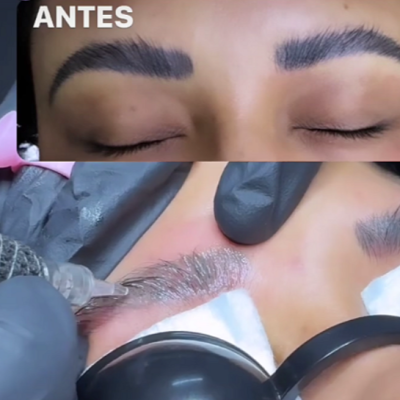 Kit&#x20;Remove&#x20;&amp;&#x20;Repair&#x2122;&#x20;&#x2013;&#x20;Remove&#x20;Pigmentos&#x20;e&#x20;Regenera&#x20;a&#x20;Pele