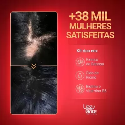 Kit&#x20;Sos&#x20;Crescimento&#x20;E&#x20;Kit&#x20;Ampolas&#x20;Potencializadora&#x20;Lizz&#x20;Ante&#x2705;PRONTA&#x20;ENTREGA