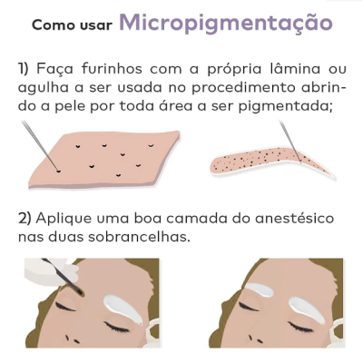 Anest&#x00E9;sico&#x20;Pele&#x20;Aberta&#x20;&#x2122;&#x20;-&#x20;Zero&#x20;Dor&#x20;Nanotecnol&#x00F3;gico&#x20;15g