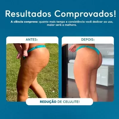 Gel&#x20;Queima&#x20;Gordura&#x20;Celulite&#x20;E&#x20;Flacidez&#x20;200g&#x20;-&#x20;Cicatribem&#x2705;PRONTA&#x20;ENTREGA