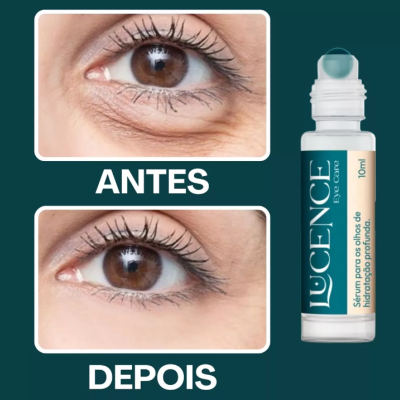 Eye&#x20;Care&#x20;Ser&#x00FA;m&#x20;de&#x20;Olhos&#x20;-&#x20;Lucence