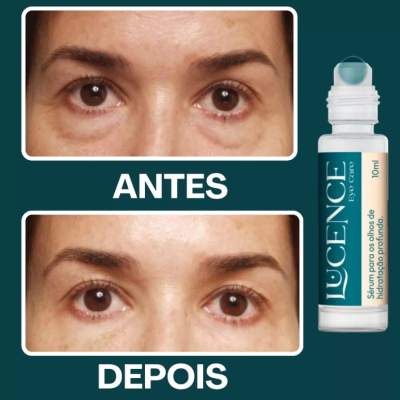 Eye&#x20;Care&#x20;Ser&#x00FA;m&#x20;de&#x20;Olhos&#x20;-&#x20;Lucence