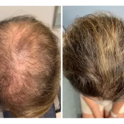 T&#x00F4;nico&#x20;Poderoso&#x20;&#x7C;&#x20;60&#x20;C&#x00E1;psulas&#x20;-&#x20;Cresc&#x20;Acelerado&#x20;&#x7C;&#x20;Anti-queda&#x20;Gold&#x20;Spell