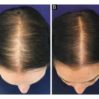 T&#x00F4;nico&#x20;Poderoso&#x20;&#x7C;&#x20;60&#x20;C&#x00E1;psulas&#x20;-&#x20;Cresc&#x20;Acelerado&#x20;&#x7C;&#x20;Anti-queda&#x20;Gold&#x20;Spell