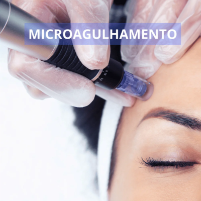 Zero&#x20;Dor&#x20;Pele&#x20;Fechada&#x20;&#x2122;&#x20;-&#x20;Dessensibilizante&#x20;Micropigmenta&#x00E7;&#x00E3;o