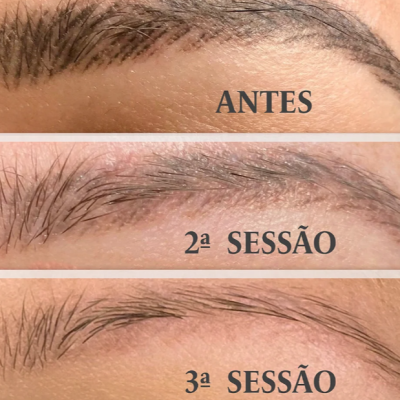 Kit&#x20;Remove&#x20;&amp;&#x20;Repair&#x2122;&#x20;&#x2013;&#x20;Remove&#x20;Pigmentos&#x20;e&#x20;Regenera&#x20;a&#x20;Pele