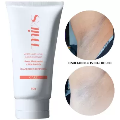 Creme clareador corporal SiniuS com texto e imagens de axilas antes e depois de uso