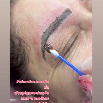 Kit&#x20;Remove&#x20;&amp;&#x20;Repair&#x2122;&#x20;&#x2013;&#x20;Remove&#x20;Pigmentos&#x20;e&#x20;Regenera&#x20;a&#x20;Pele